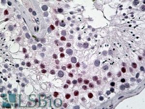 Goat Anti-DENTT / CDA1 Antibody