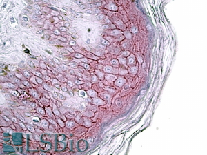 Goat Anti-Desmoglein 1 / DSG1 Antibody