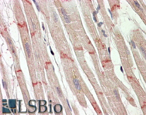 Goat Anti-Desmoplakin (aa 1672 -1684) Antibody