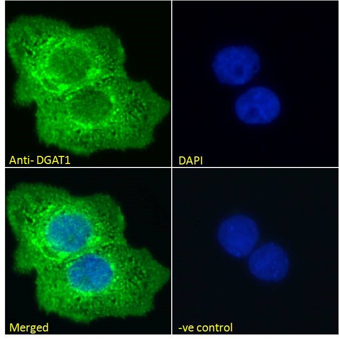 Goat Anti-DGAT1 Antibody