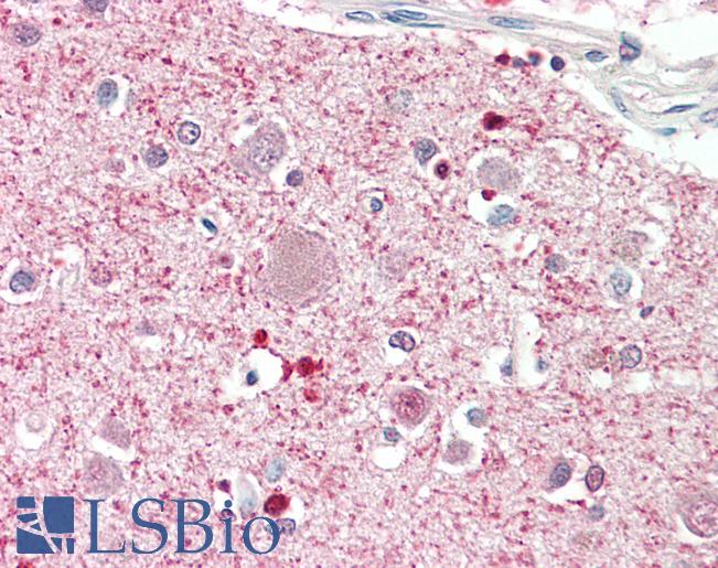 Goat Anti-DGKQ (aa295-298) Antibody