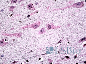 Goat Anti-Dicer1 Antibody