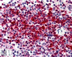 Goat Anti-DKC1 Antibody