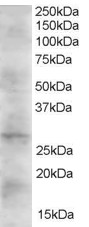 Goat Anti-DKK2 Antibody