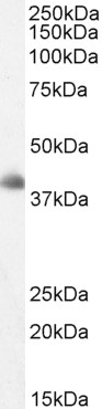 Goat Anti-DKK3 / REIC Antibody