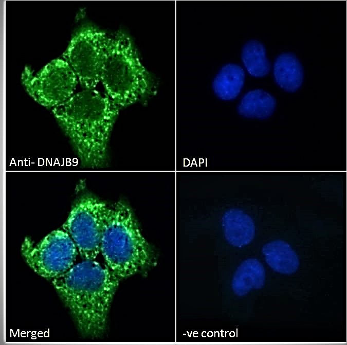Goat Anti-DNAJB9 (aa61-75) Antibody