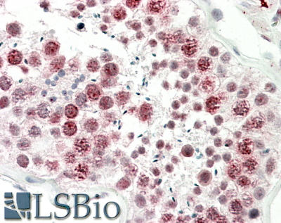 Goat Anti-DNAJC5G (human) Antibody