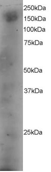 Goat Anti-DOCK1 Antibody