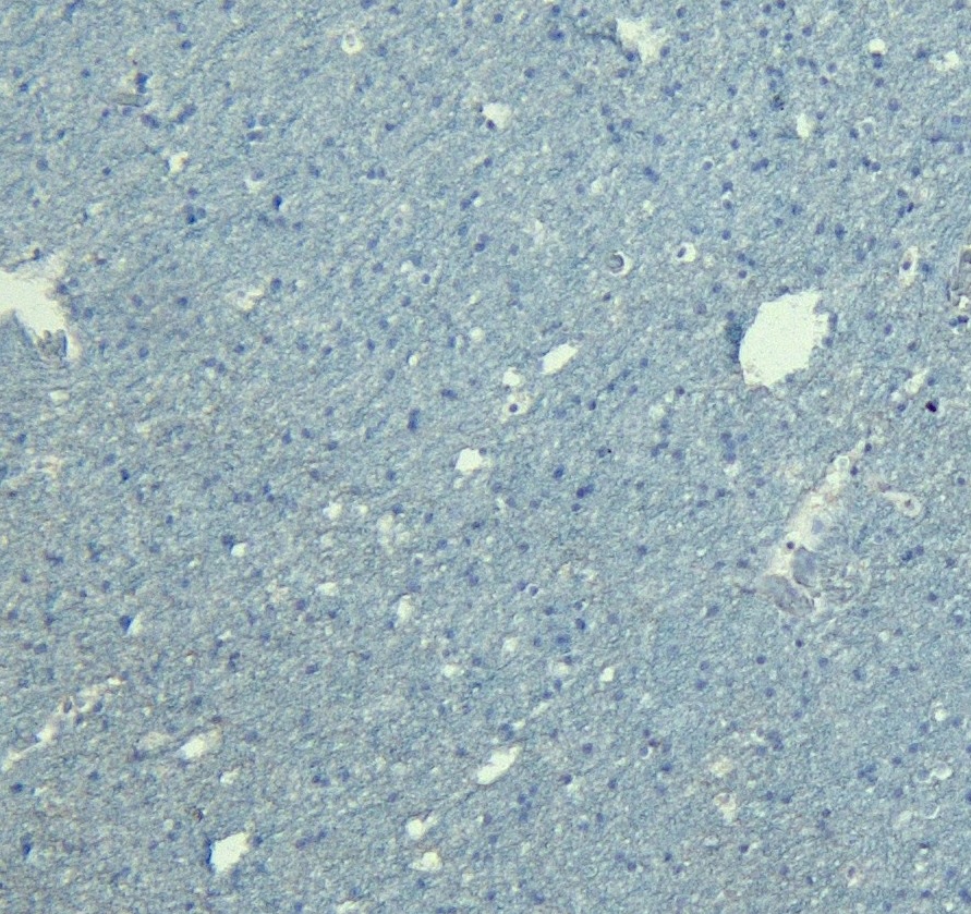 Goat Anti-Doublecortin / DCX  (aa232-242) Antibody