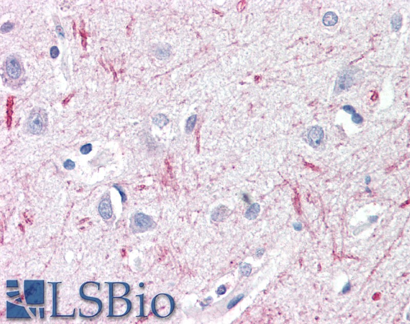 Goat Anti-DTX3 Antibody