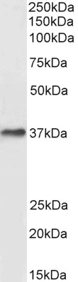 Goat Anti-Duffy / FY / DARC Antibody