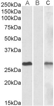Goat Anti-DYDC1 Antibody