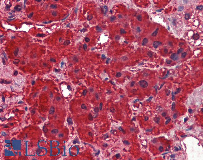 Goat Anti-Dynamin 3 Antibody