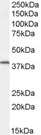 Goat Anti-Dysadherin Antibody