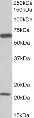 Goat Anti-EAAT1 / GLAST1 (aa197-208) Antibody