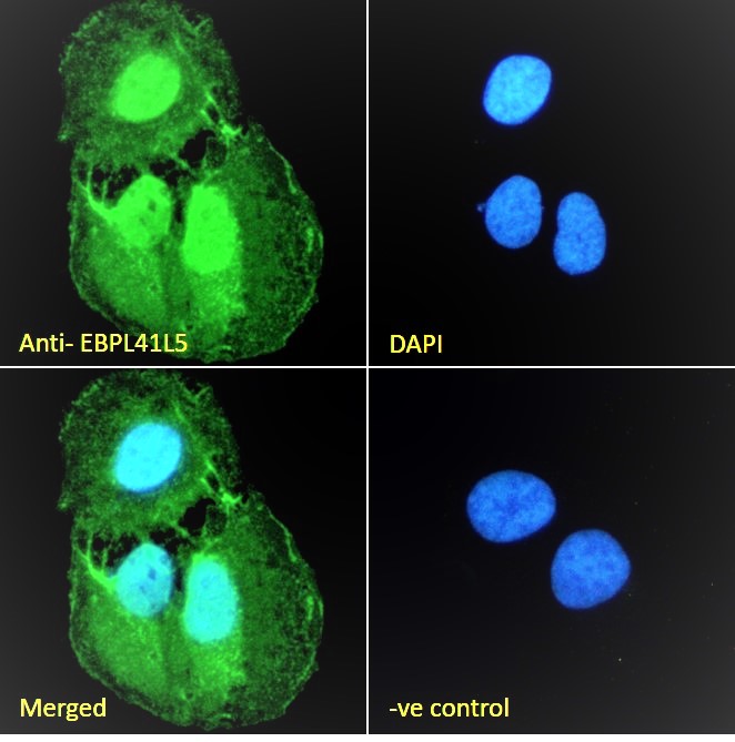 Goat Anti-EBPL41L5 Antibody