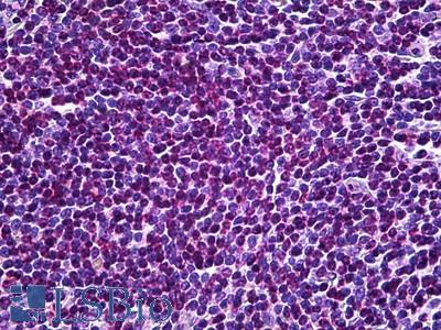 Goat Anti-EDD1 / HYD Antibody