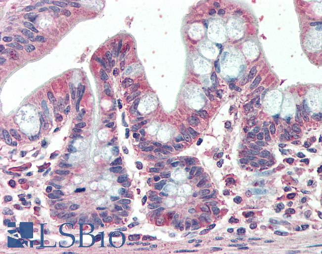 Goat Anti-EML5 Antibody