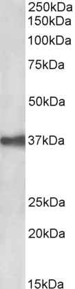 Goat Anti-EPCAM / TROP1 (aa167-179) Antibody