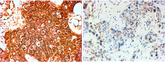 Goat Anti-ERBB2 / HER2 (aa182-194) Antibody