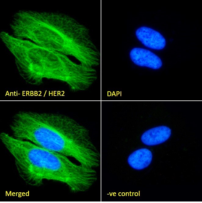 Goat Anti-ERBB2 / HER2 Antibody