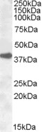 Goat Anti-ERCC1 Antibody