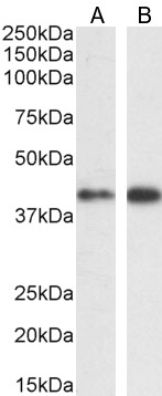 Goat Anti-MAPK3/ERK1 Antibody