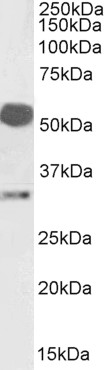 Goat Anti-Estrogen receptor 2 Antibody