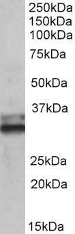 Goat Anti-ETFA (aa139-152) Antibody