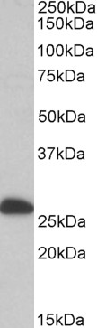 Goat Anti-ETFB / FP585 (aa 152-165) Antibody