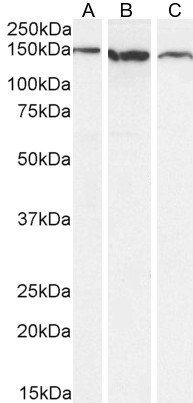Goat Anti-EVI1 /  AML1 Antibody
