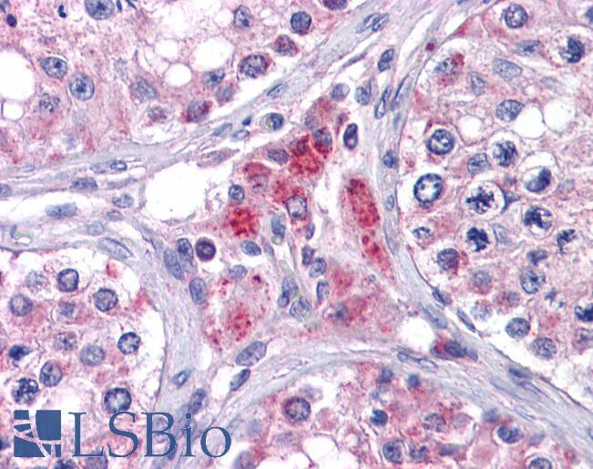 Goat Anti-EYA4 Antibody