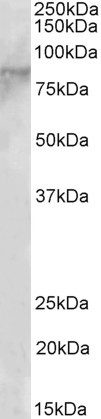 Goat Anti-EZH1 Antibody