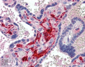 Goat Anti-Factor XIIIa (49-62) Antibody