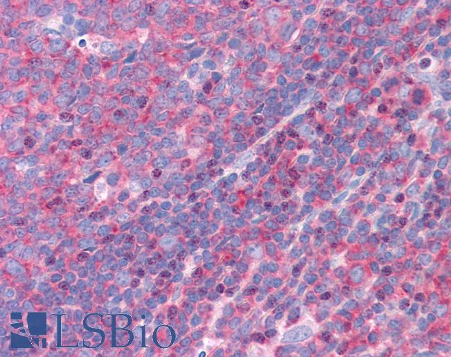 Goat Anti-FBP17 / FNBP1 Antibody