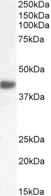Goat Anti-FBXO32 Antibody