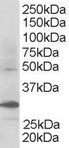 Goat Anti-FBXW2 Antibody
