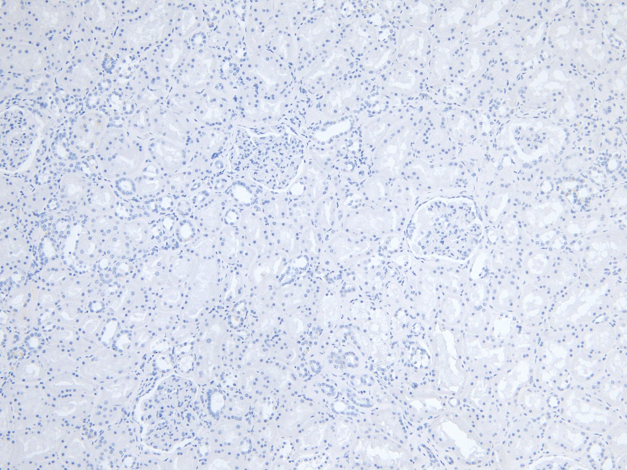 Goat Anti-FCER1A (aa177-189) Antibody