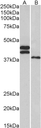 Goat Anti-FCRL1 (aa165-177) Antibody
