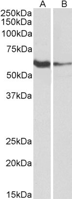 Goat Anti-FCRL2 (aa92-104) Antibody