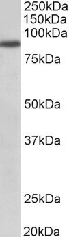 Goat Anti-FGFR1 Antibody