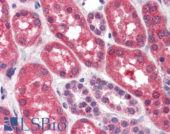 Goat Anti-FGFR1 Antibody