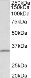 Goat Anti-fibrillarin / FBL (aa99-110) Antibody