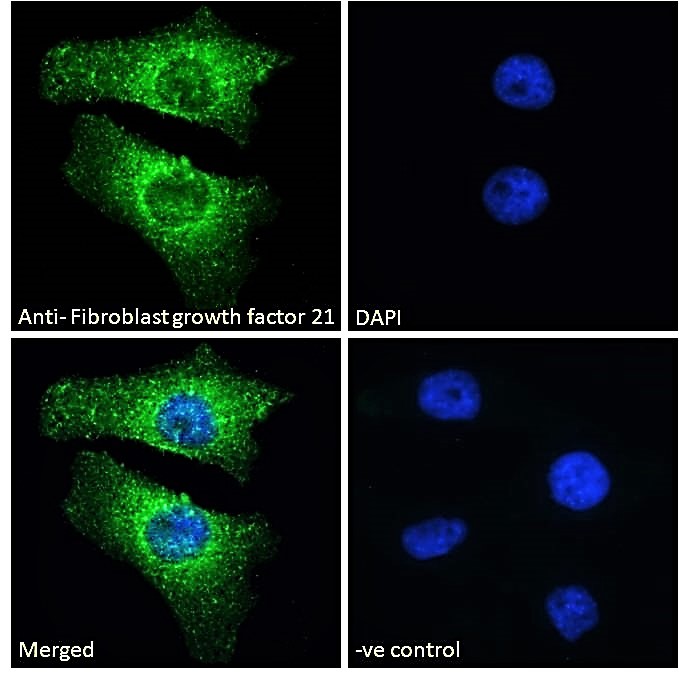 Goat Anti-Fibroblast growth factor 21 Antibody