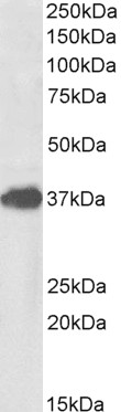Goat Anti-FOXF1 Antibody
