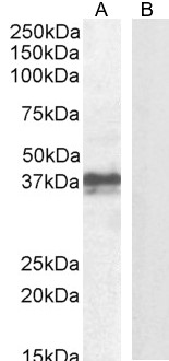 Goat Anti-Foxi3 (mouse) Antibody