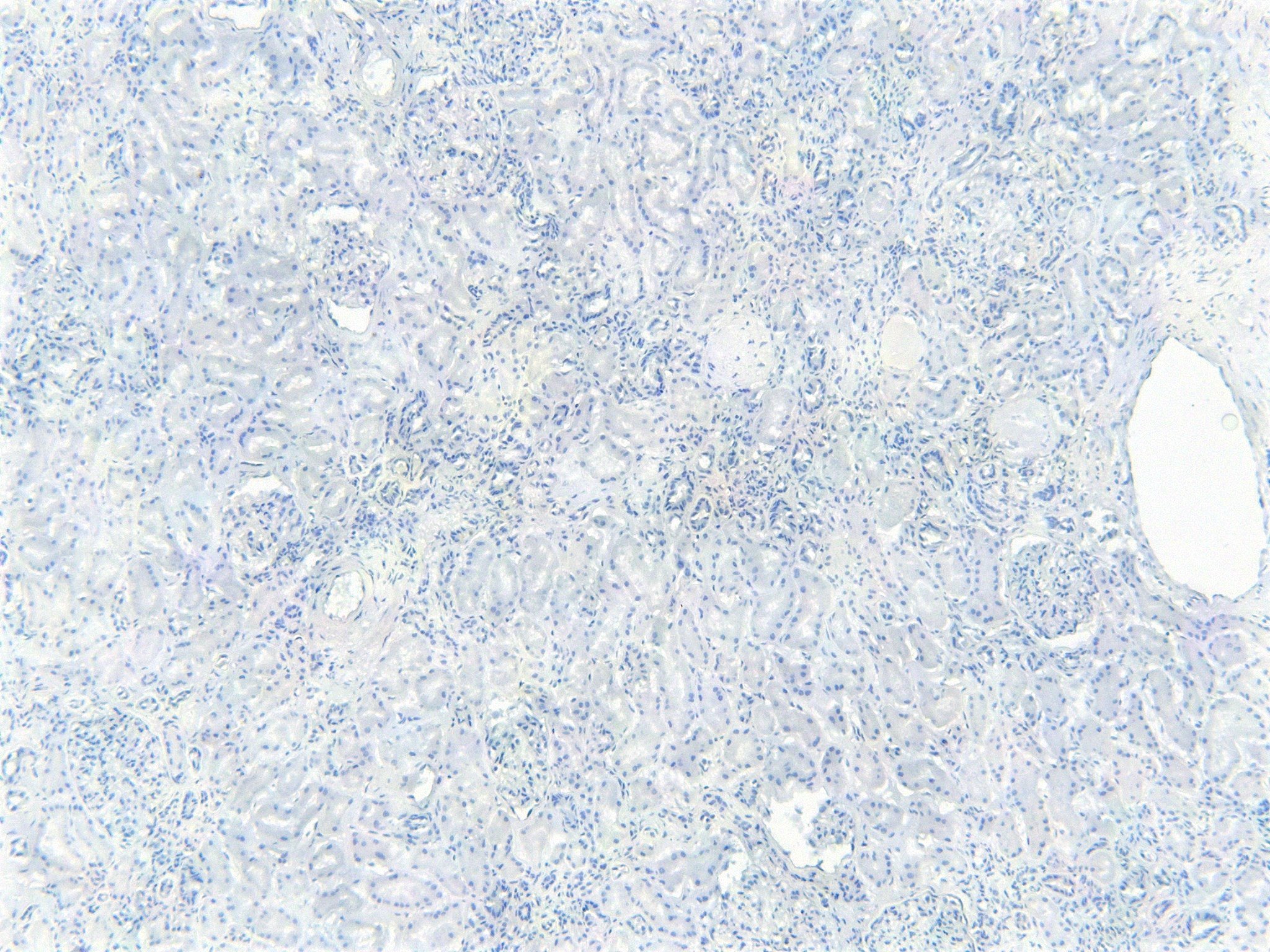 Goat Anti-FOXO3A / FOXO3 / FKHRL1 Antibody