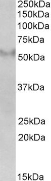 Goat Anti-FSD1 Antibody