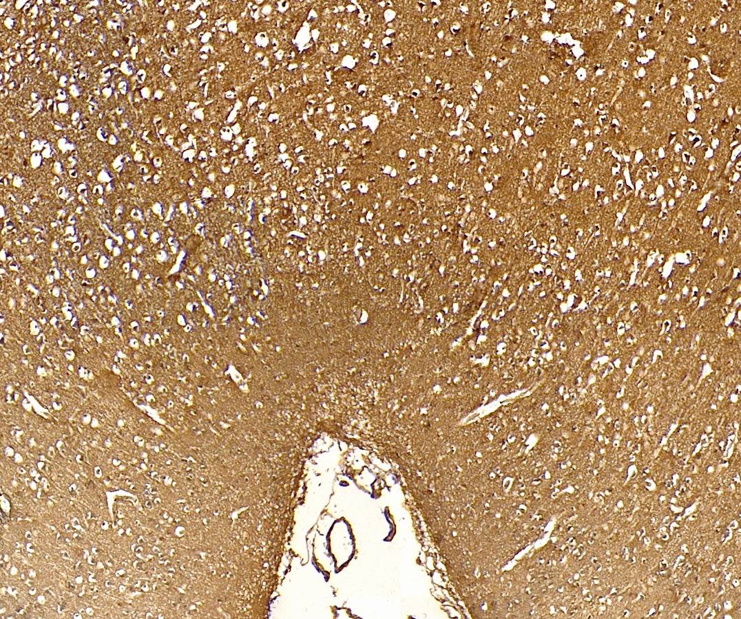 Goat Anti-FTH1 Antibody