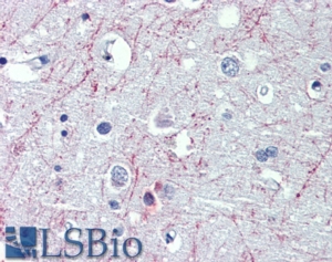 Goat Anti-GABBR1 Antibody